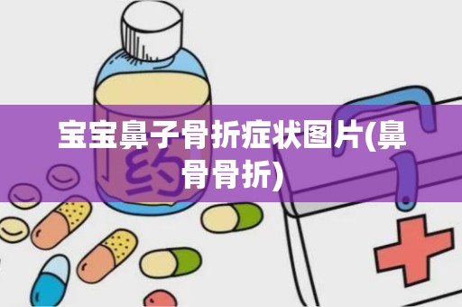 宝宝鼻子骨折症状图片(鼻骨骨折)