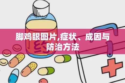 脚鸡眼图片,症状、成因与防治方法