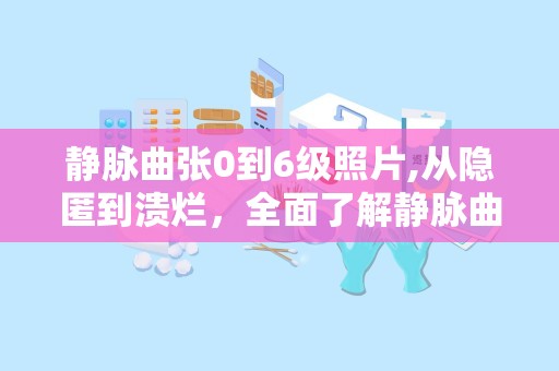 静脉曲张0到6级照片,从隐匿到溃烂，全面了解静脉曲张的演变过程
