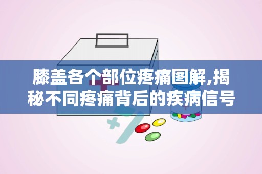 膝盖各个部位疼痛图解,揭秘不同疼痛背后的疾病信号