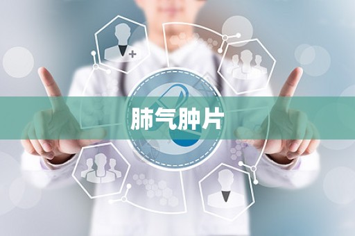 肺气肿片