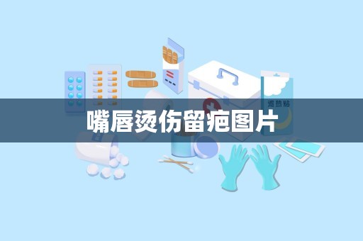 嘴唇烫伤留疤图片