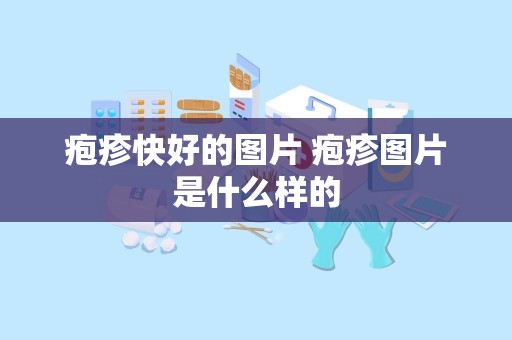 疱疹快好的图片 疱疹图片是什么样的