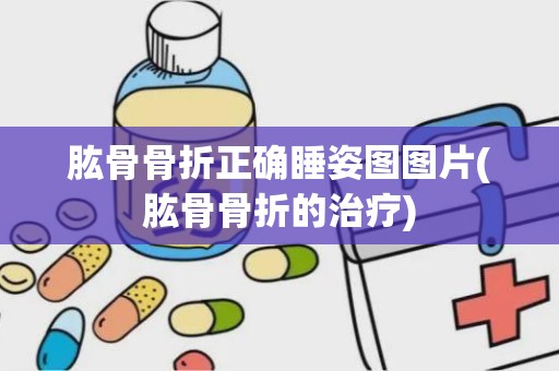 肱骨骨折正确睡姿图图片(肱骨骨折的治疗)