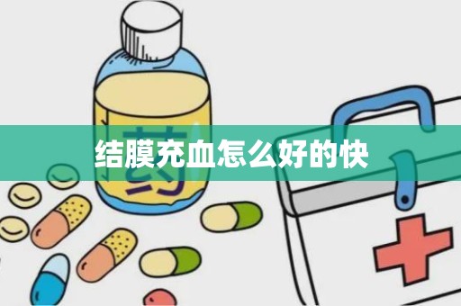 结膜充血怎么好的快