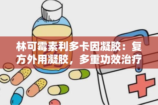 林可霉素利多卡因凝胶：复方外用凝胶，多重功效治疗皮肤感染与疼痛